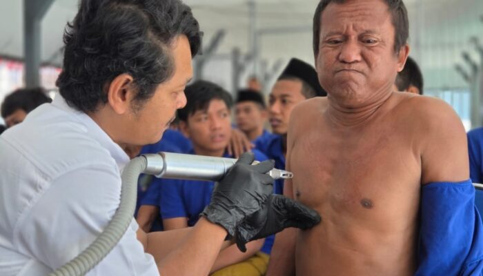 Rutan sampang gelar hapus tato gratis bagi warga binaan